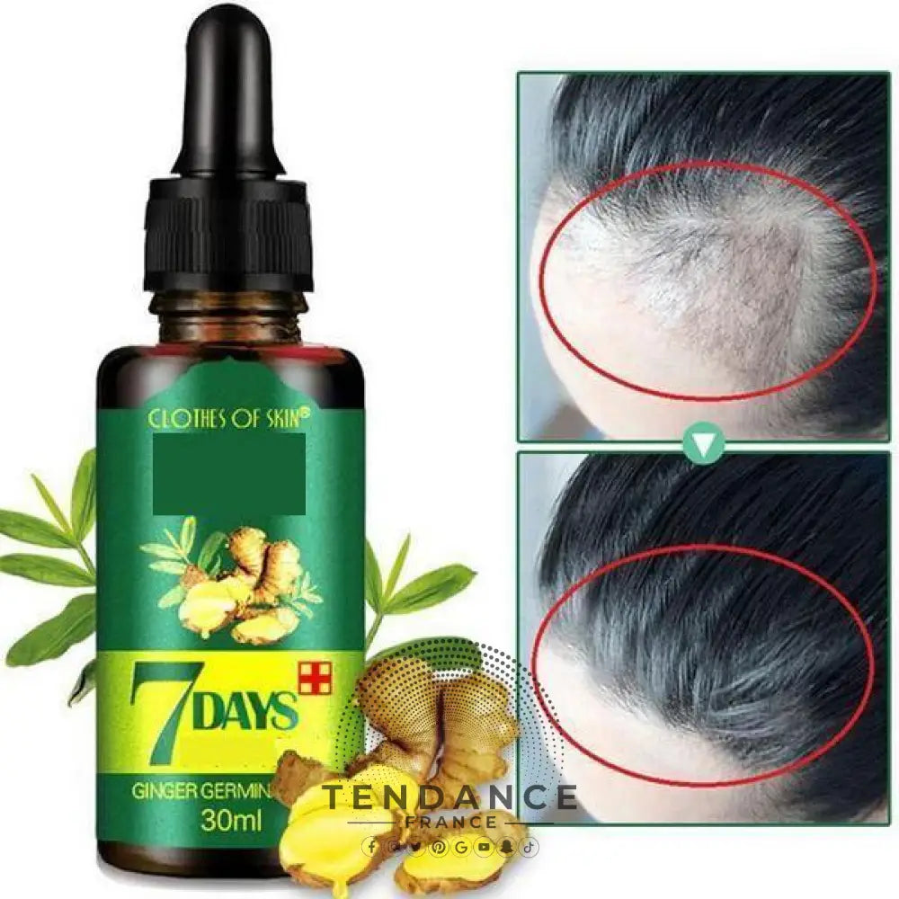 Sérum Naturel Contre La Perte De Cheveux | France-Tendance